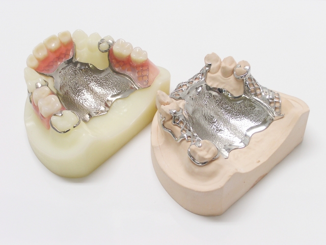 金属（チタン）床義歯